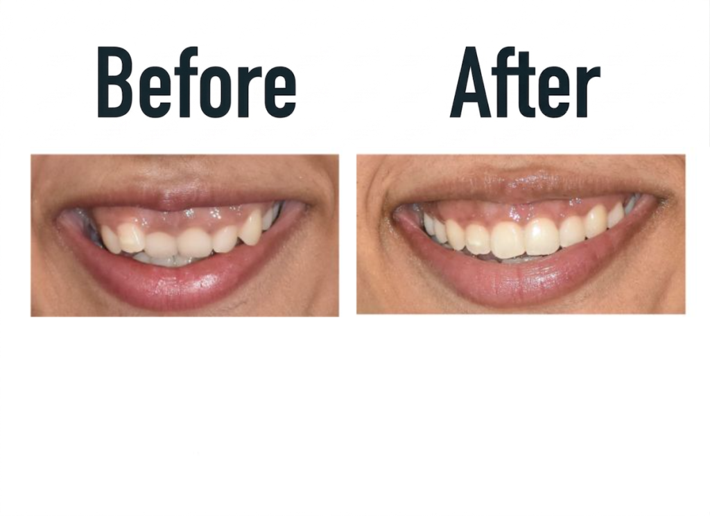 best orthodontist in gururgam